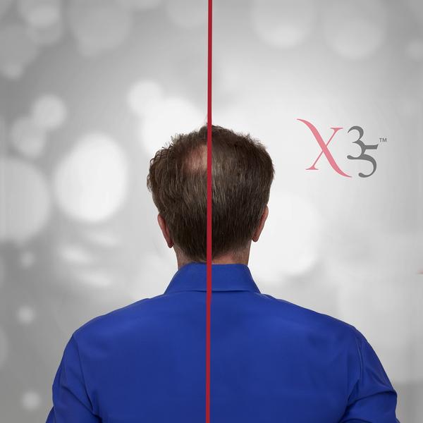 XCellerate 35 Haarwuchs-Serum